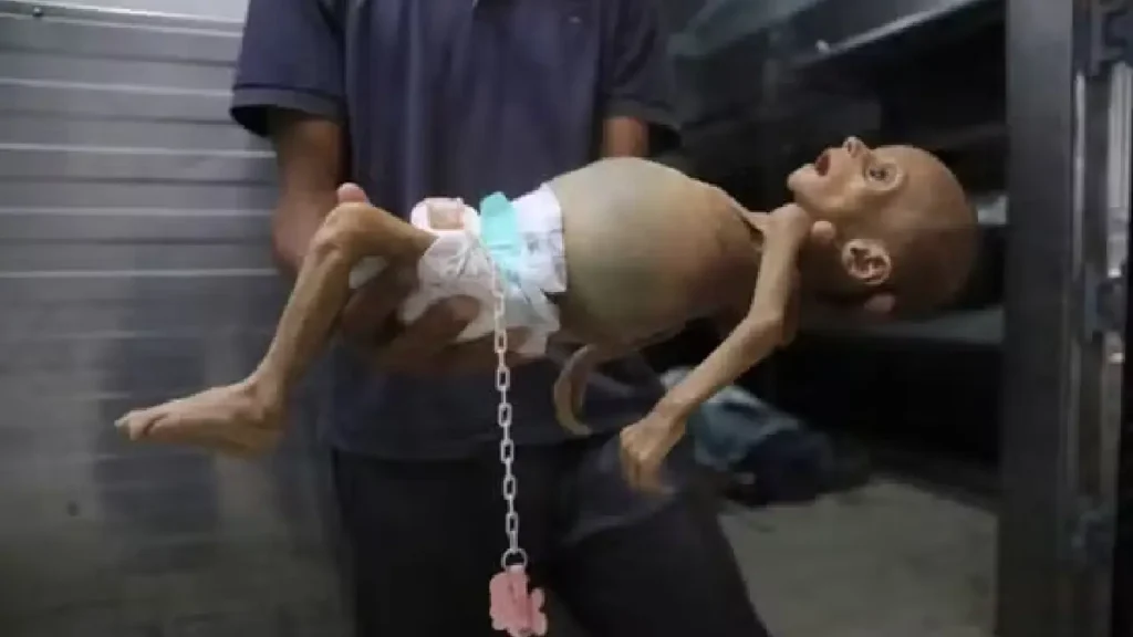 Le corps de Zainab Abu Halib, un bébé de 5 mois mort de malnutrition, à l’hôpital Nasser, Khan Younès, dans la bande de Gaza, le samedi 26 juillet 2025. MARIAM DAGGA / AP