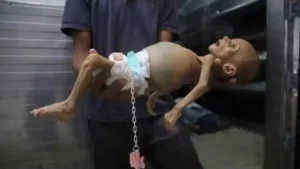 Le corps de Zainab Abu Halib, un bébé de 5 mois mort de malnutrition, à l’hôpital Nasser, Khan Younès, dans la bande de Gaza, le samedi 26 juillet 2025. MARIAM DAGGA / AP
