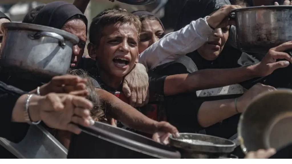 © UNICEF/Mohammed Nateel Les taux de malnutrition n'ont cessé d'augmenter à Gaza depuis mars 2025.