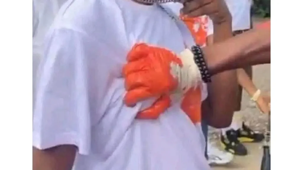 Image des attouchements au Festi Color. Photo publiée par Tzo le Specimen